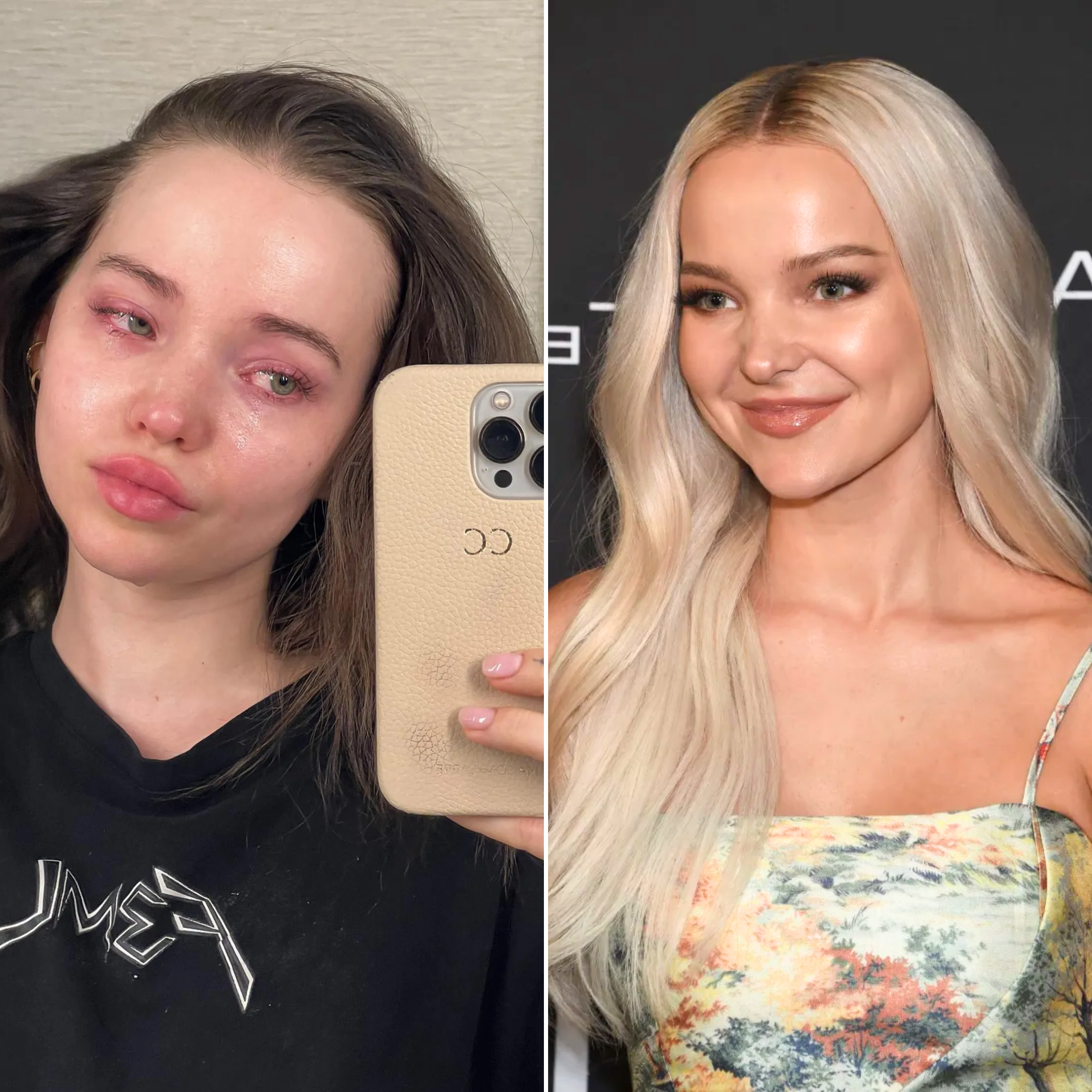 Dove Cameron ‘Surprised Herself’ by Going Back to Blonde — and Dealt with ‘Self-Hatred’ in the Process